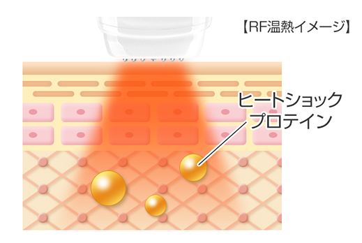 RFの原理